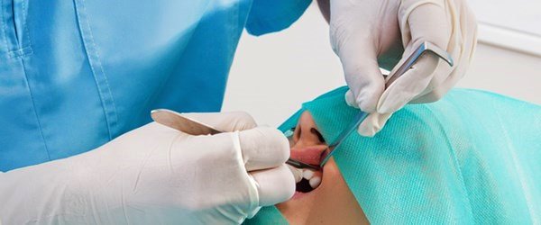 Drronins_Smilezone_Dental_Clinic_Muvattupuzha-oral-surgery
