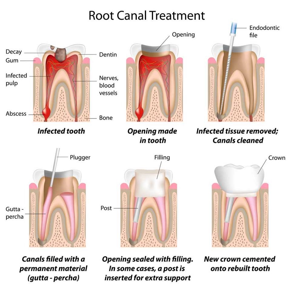 Drronins_Smilezone_Dental_Clinic_Muvattupuzha-rct