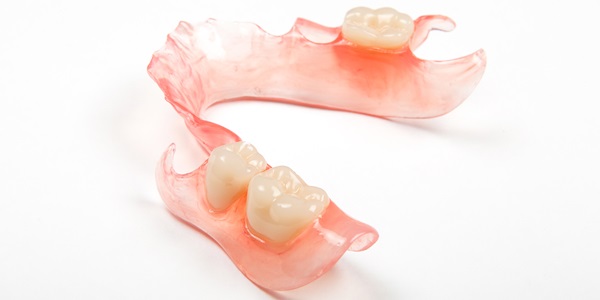 removable partial denture smilezone dental clinic muvattupuzha